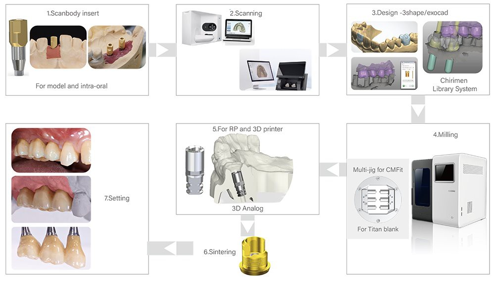 Dental CADCAM System Workflow Dental CADCAM System Workflow